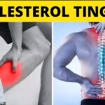 Inilah Gejala Kolesterol Tinggi yang Perlu Diwaspadai