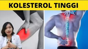 Inilah Gejala Kolesterol Tinggi yang Perlu Diwaspadai