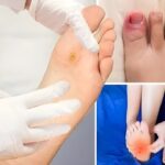 Penyakit Diabetes: Penyebab, Pola Makan, dan Cara Mencegah dari Sisi Gaya Hidup