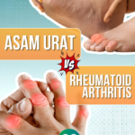 Perbedaan Asam Urat dan Rematik: Gejala, Penyebab, dan Penanganan