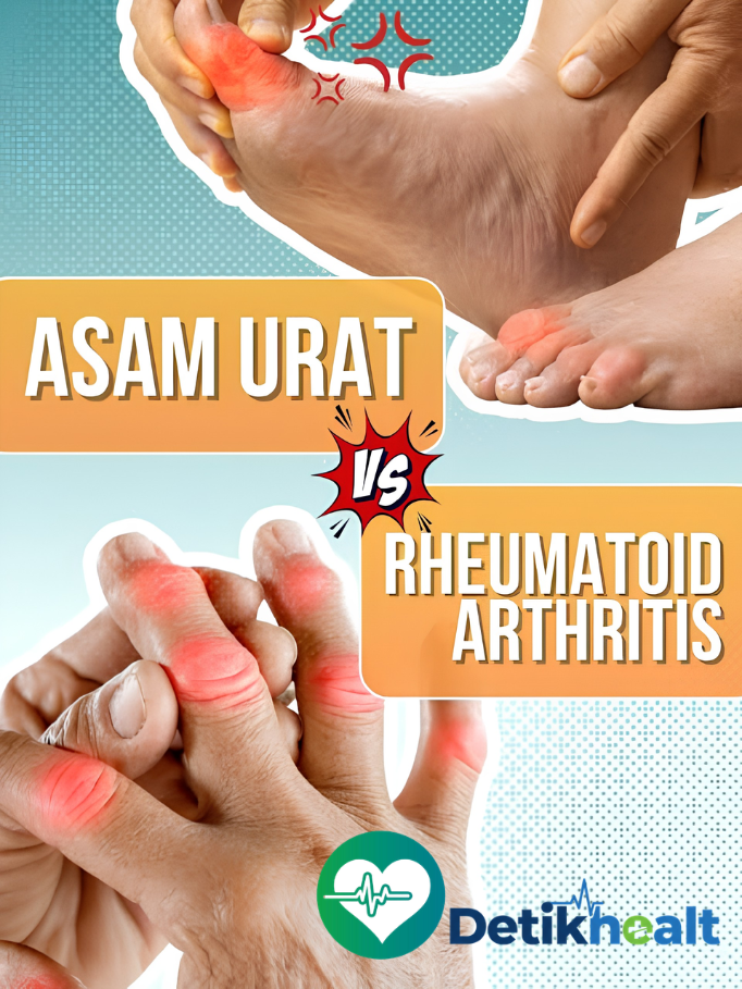 Perbedaan Asam Urat dan Rematik: Gejala, Penyebab, dan Penanganan